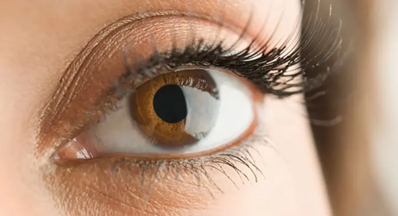 Transplante de córnea muda a cor dos olhos?
