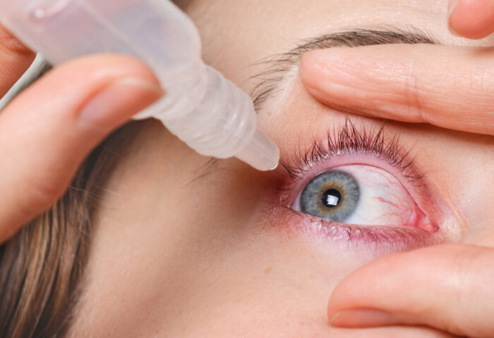 10 perguntas e respostas sobre o glaucoma