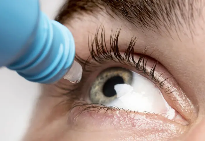 A Cirurgia Refrativa pode causar a Doença do Olho Seco?