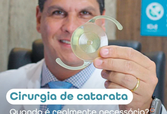 Cirurgia de Catarata: Quando realmente é necessária?