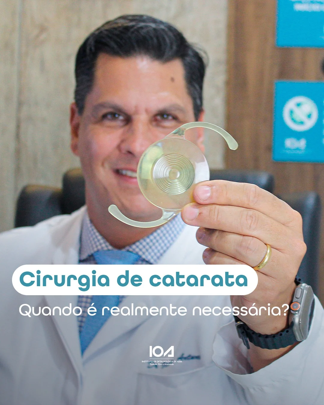 Cirurgia De Catarata Quando Realmente Necess ria IOA